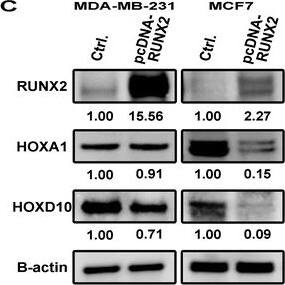 Detection of Human HOXA1 by Western Blot