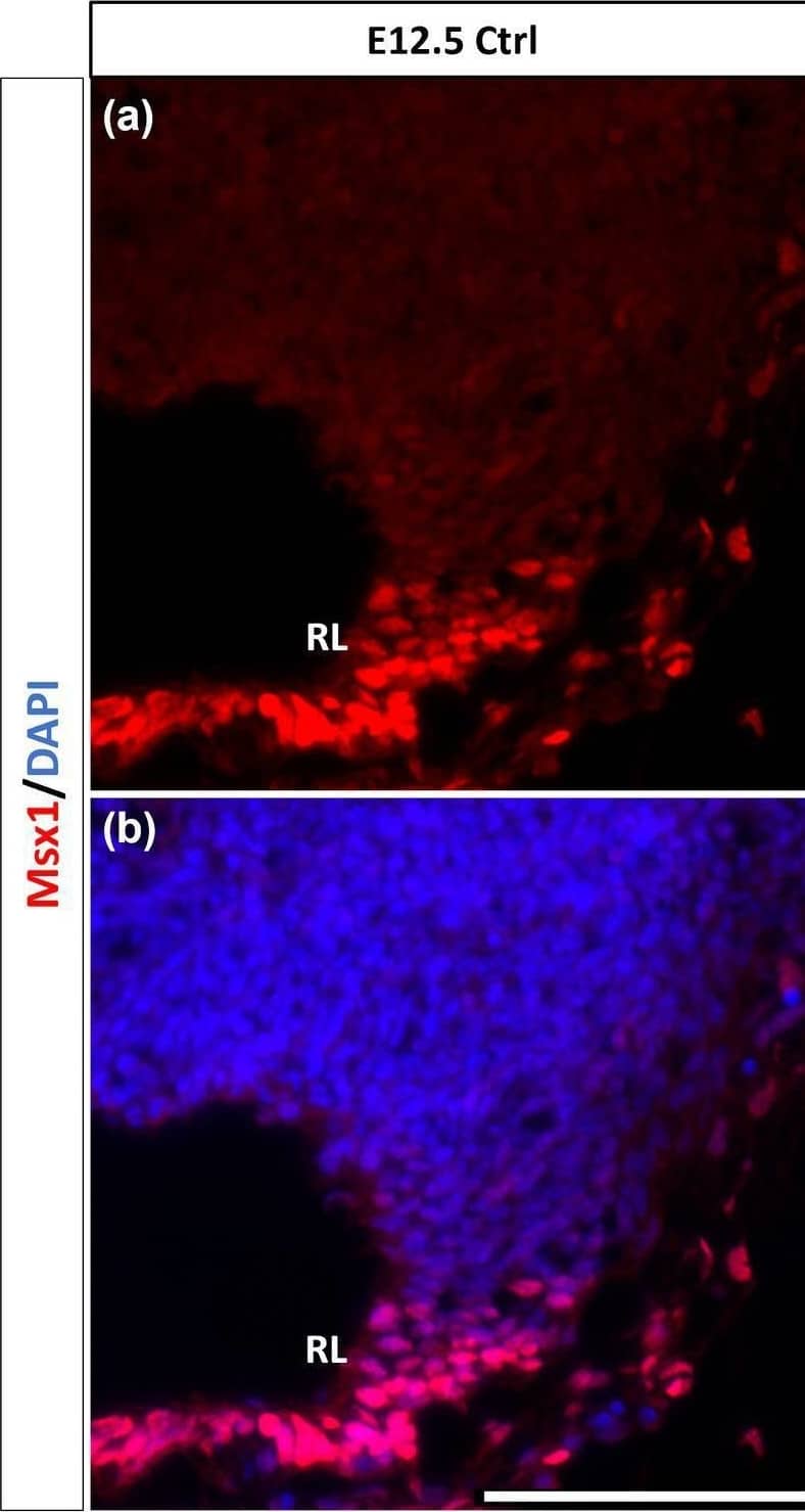 Detection of Mouse MSX1 by Immunohistochemistry