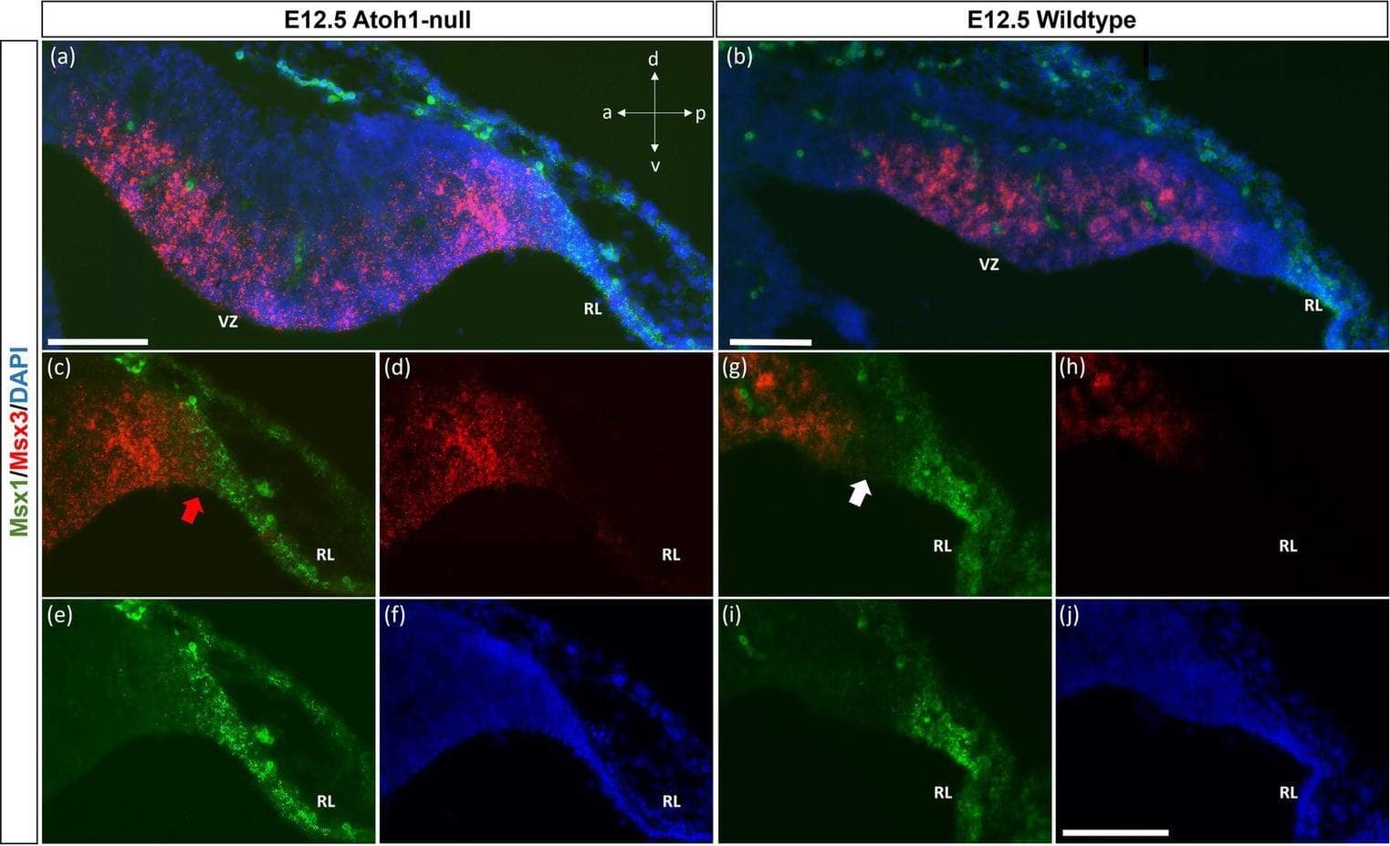 Detection of Mouse MSX1 by Immunohistochemistry