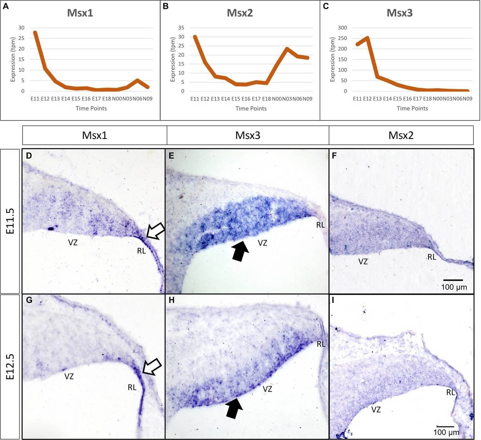 Detection of Mouse MSX1 by Immunohistochemistry