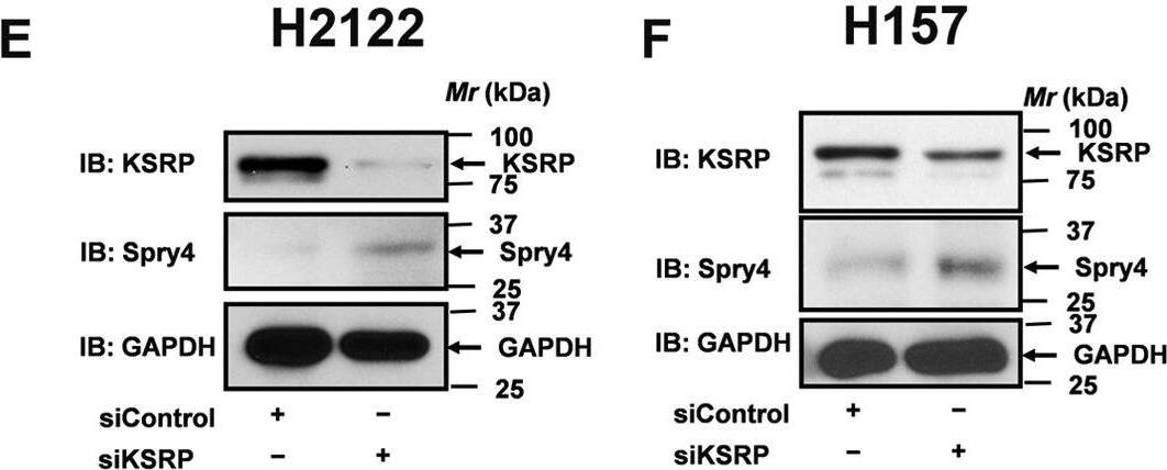 Detection of Human SPRY4 by Western Blot