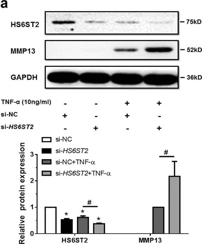 Detection of MMP-13 by Western Blot