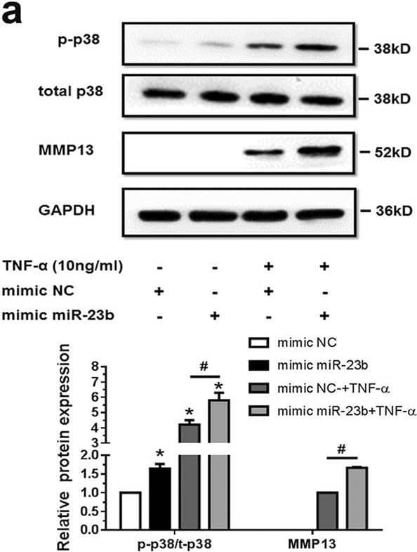 Detection of MMP-13 by Western Blot