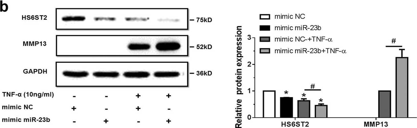 Detection of MMP-13 by Western Blot