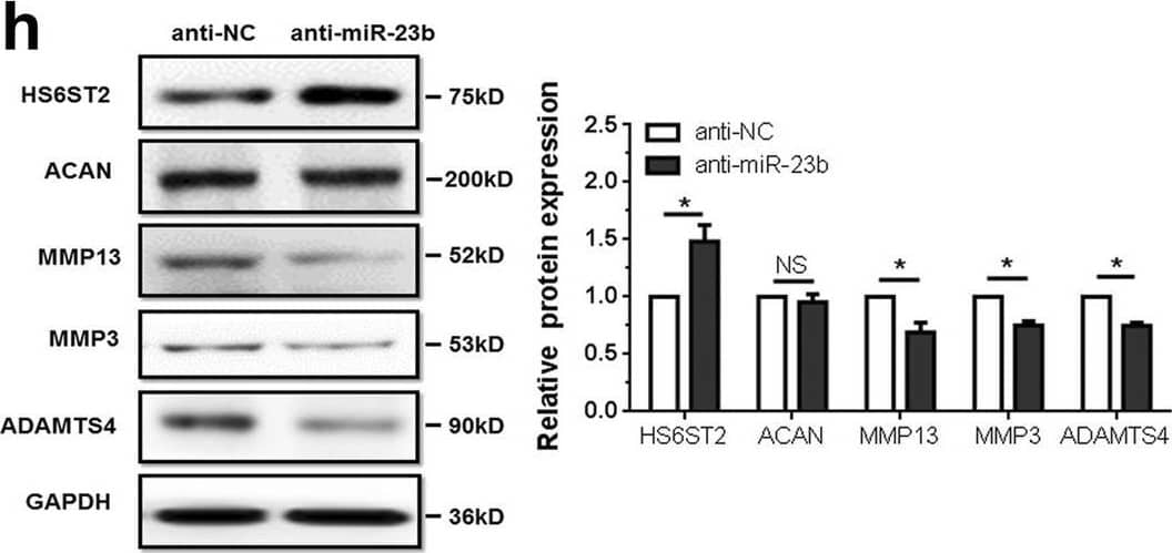 Detection of MMP-13 by Western Blot