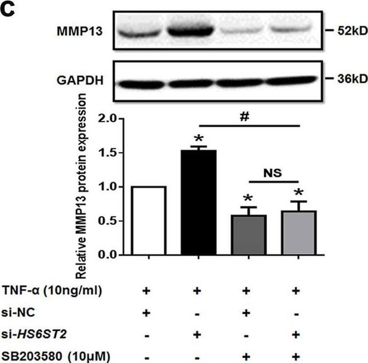 Detection of MMP-13 by Western Blot