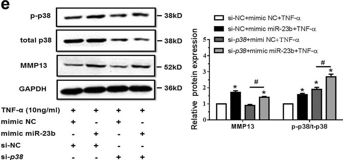 Detection of MMP-13 by Western Blot