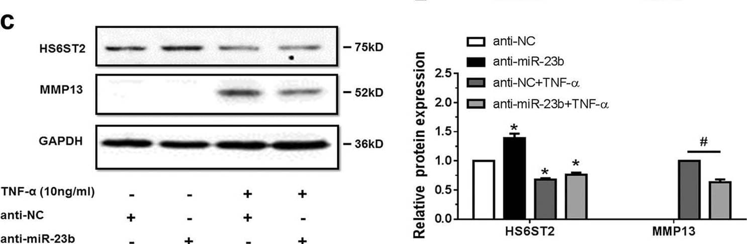 Detection of MMP-13 by Western Blot