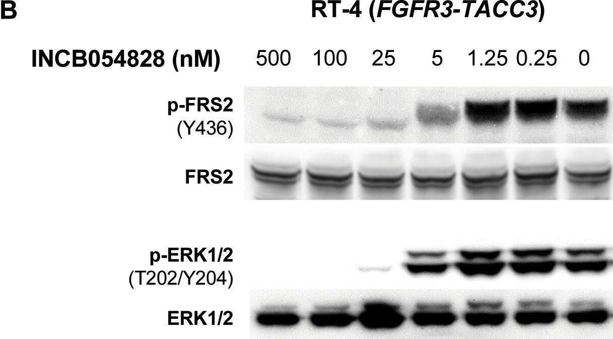Detection of Phospho-FRS2 (Y436) by Western Blot