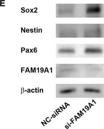 Detection of TAFA1/FAM19A1 by Western Blot