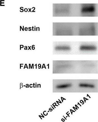 Detection of TAFA1/FAM19A1 by Western Blot