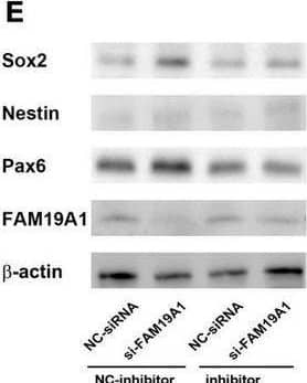 Detection of TAFA1/FAM19A1 by Western Blot