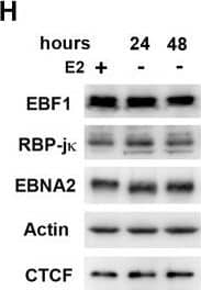 Detection of Human EBF-1 by Western Blot