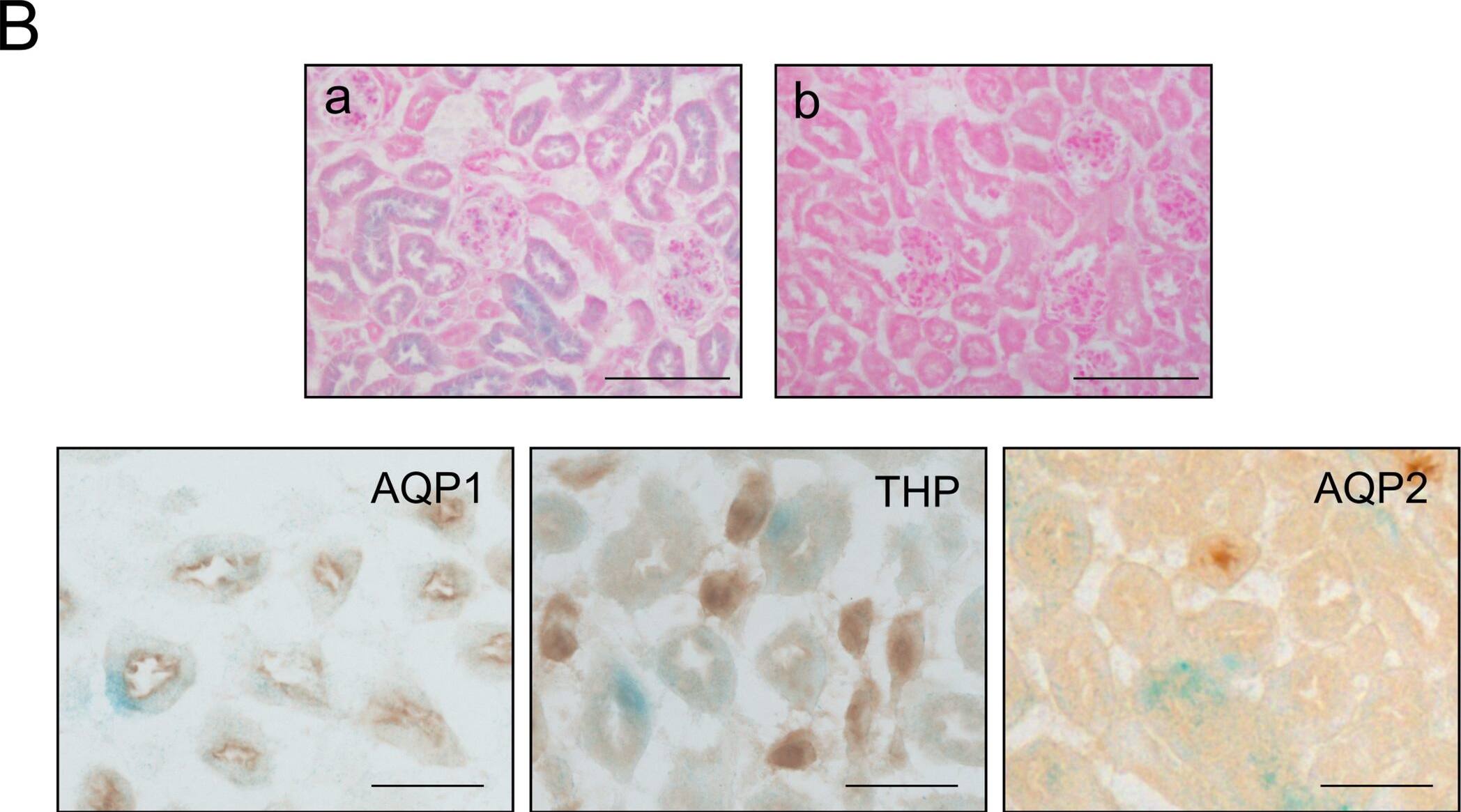 Detection of Mouse Uromodulin by Immunohistochemistry