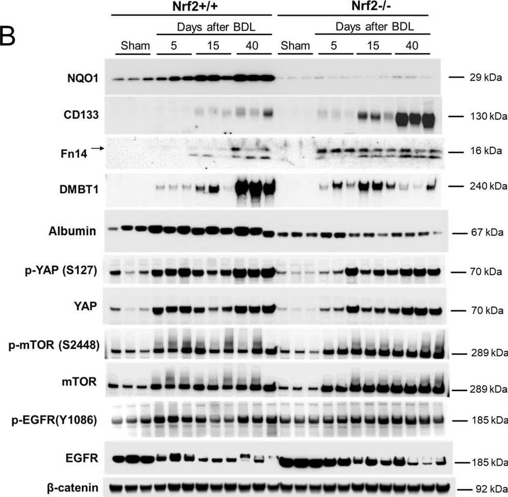 Detection of IL-34 by Western Blot