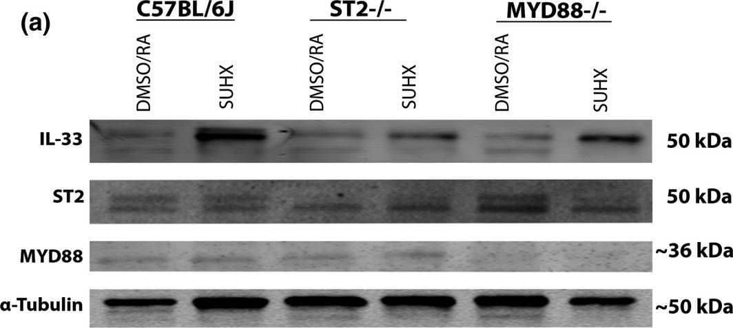 Detection of ST2/IL-33R by Western Blot
