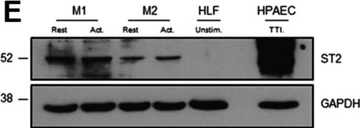 Detection of ST2/IL-33R by Western Blot