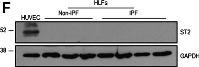 Detection of ST2/IL-33R by Western Blot