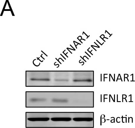 Detection of IL-28 R alpha /IFN-lambda R1 by Western Blot