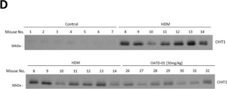Detection of Mouse Chitotriosidase/CHIT1 by Western Blot