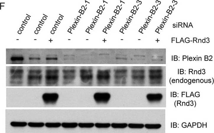 Detection of Human Plexin B2 by Knockdown Validated