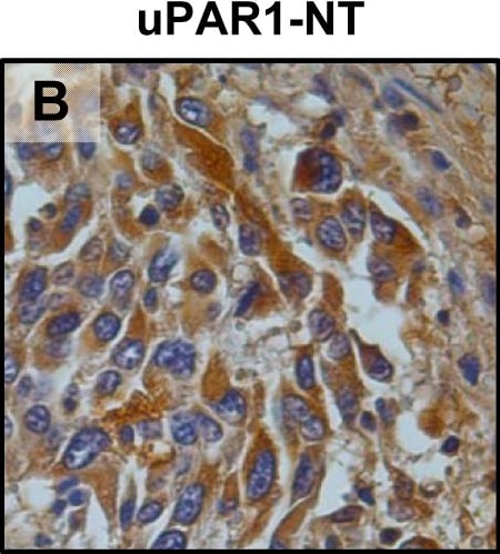 Detection of Mouse uPAR by Immunohistochemistry
