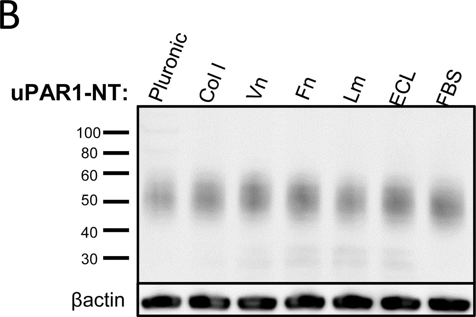 Detection of Mouse uPAR by Western Blot