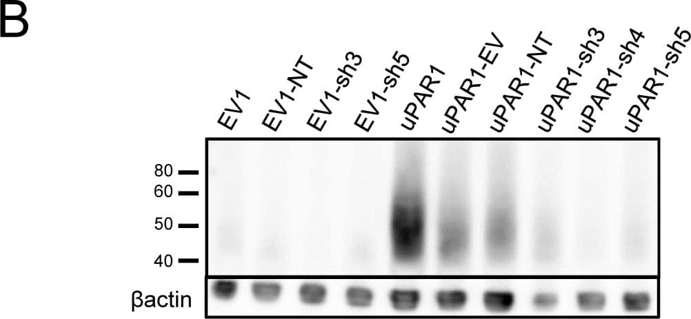 Detection of Mouse uPAR by Western Blot