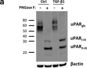 Detection of Mouse uPAR by Western Blot