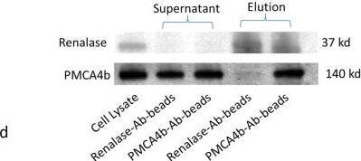 Detection of Human Renalase by Western Blot