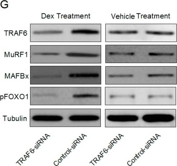 Detection of Mouse MuRF1/TRIM63 by Western Blot