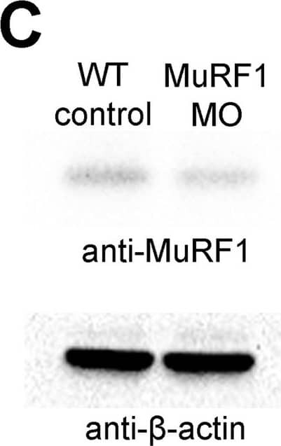 Detection of Zebrafish MuRF1/TRIM63 by Western Blot