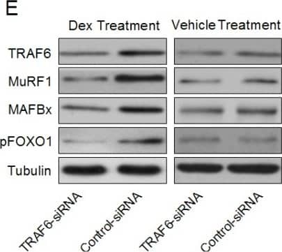 Detection of Mouse MuRF1/TRIM63 by Western Blot