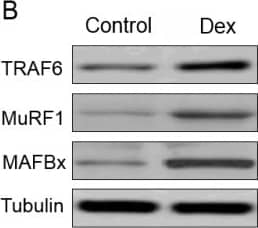 Detection of Mouse MuRF1/TRIM63 by Western Blot