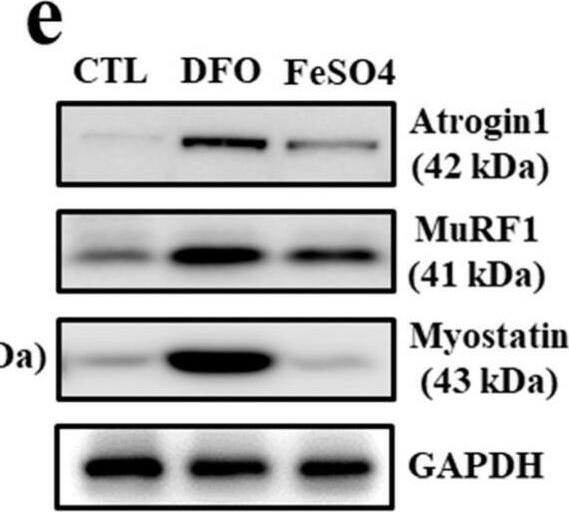 Detection of MuRF1/TRIM63 by Western Blot