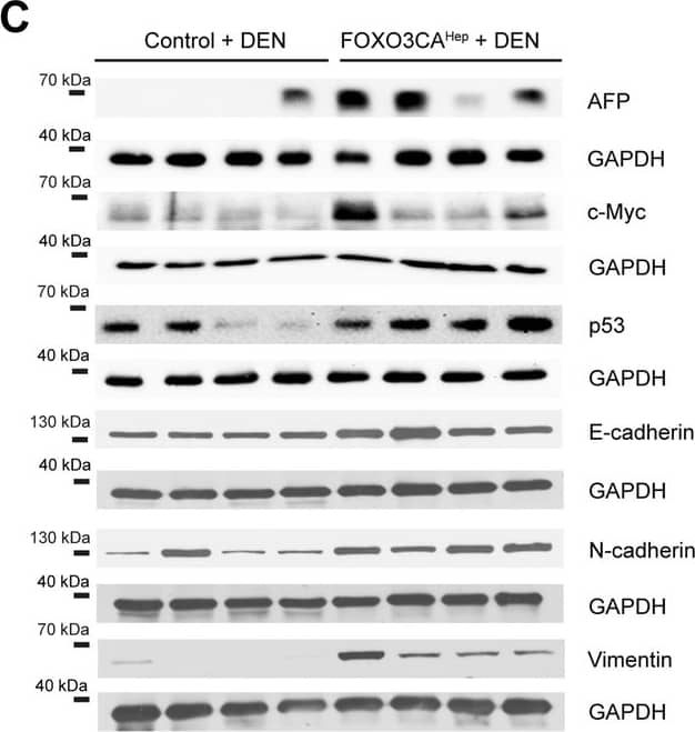 Detection of Mouse alpha-Fetoprotein/AFP by Western Blot