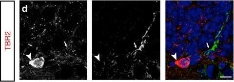Detection of Mouse Plexin C1 by Immunocytochemistry/Immunofluorescence