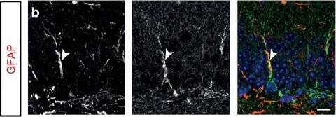 Detection of Mouse Plexin C1 by Immunocytochemistry/Immunofluorescence