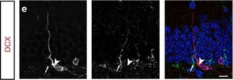 Detection of Mouse Plexin C1 by Immunocytochemistry/Immunofluorescence