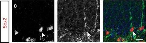Detection of Mouse Plexin C1 by Immunocytochemistry/Immunofluorescence