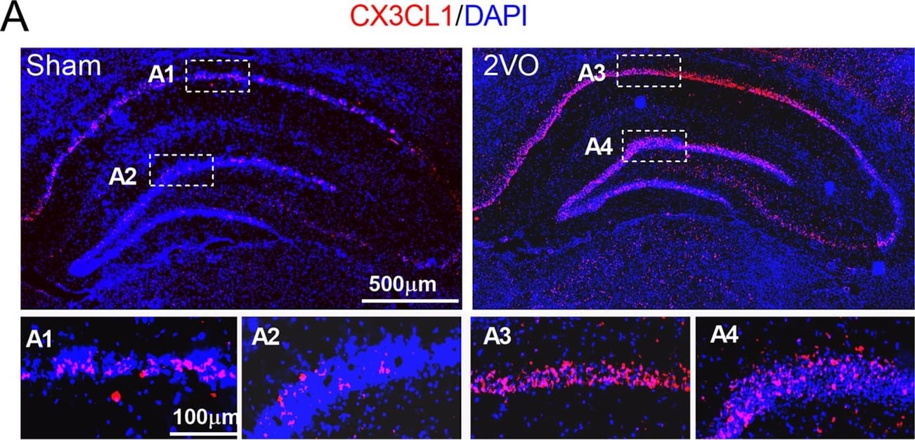 Detection of Rat CX3CL1/Fractalkine by Immunohistochemistry