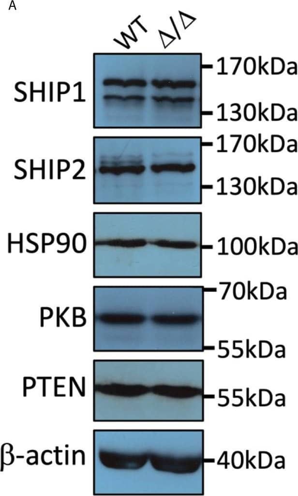 Detection of Mouse SHIP2 by Western Blot