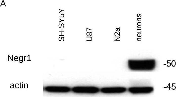 Detection of Kilon/NEGR1 by Western Blot
