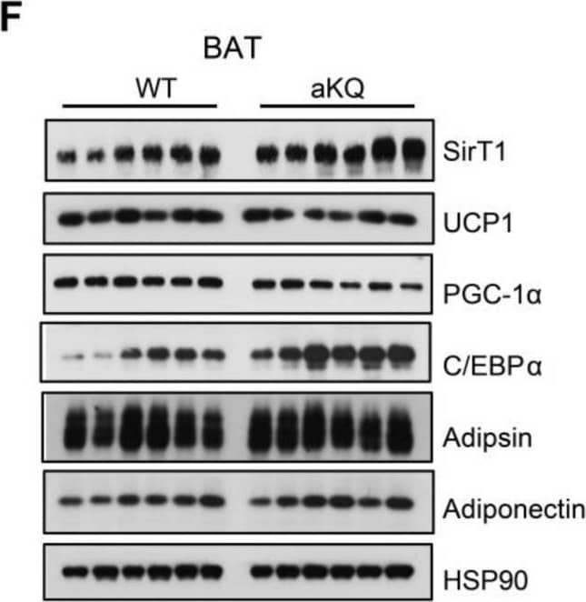 Detection of Complement Factor D/Adipsin by Western Blot