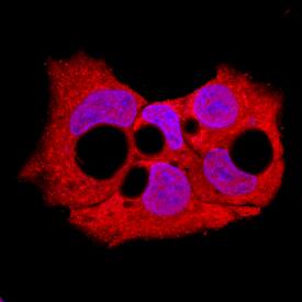 Sphingosine Kinase 1/SPHK1 antibody in HepG2 Human Cell Line by Immunocytochemistry (ICC).