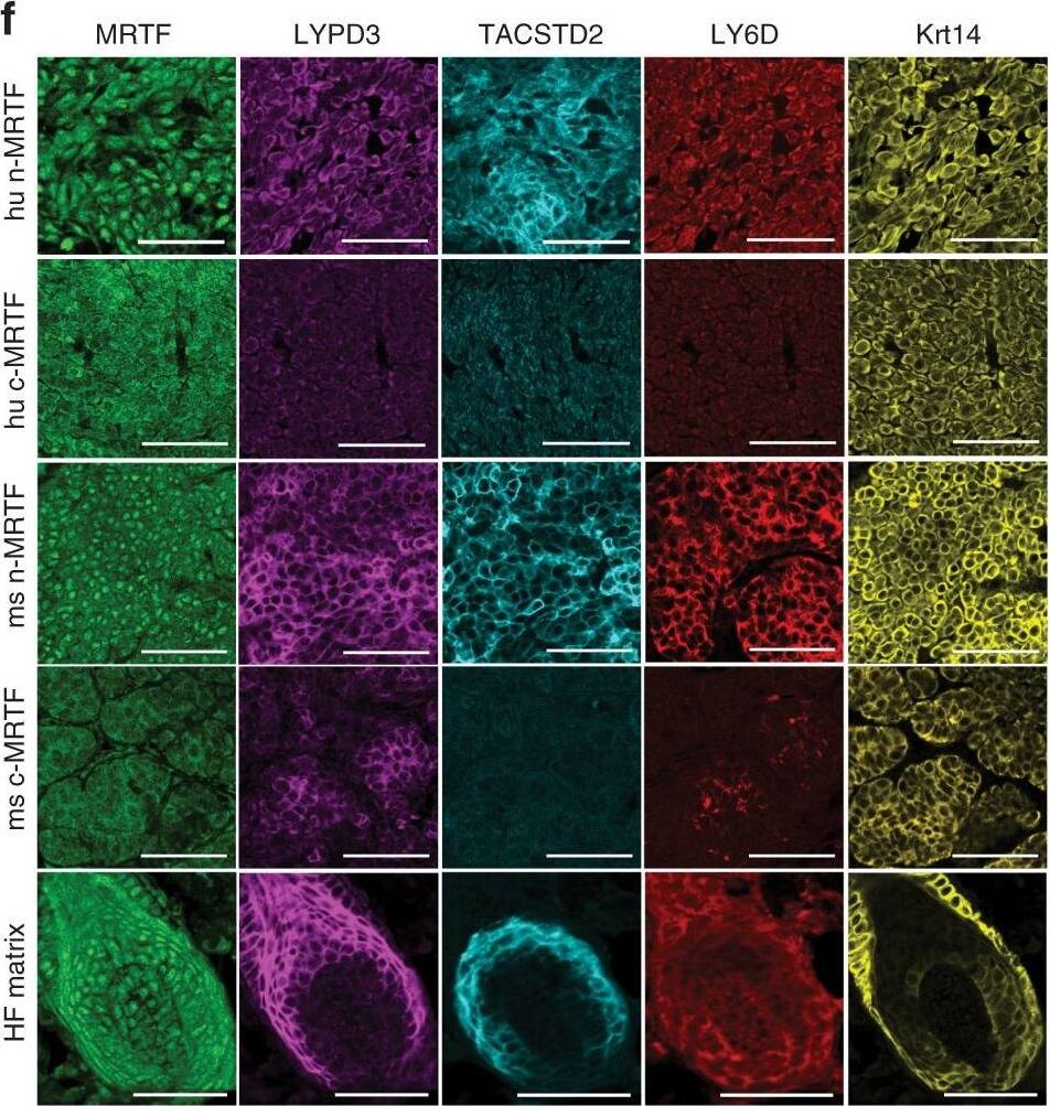 Detection of Human C4.4A/LYPD3 by Immunohistochemistry