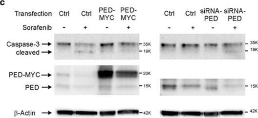 Detection of Human PEA-15 by Western Blot