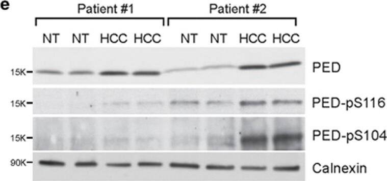 Detection of Human PEA-15 by Western Blot