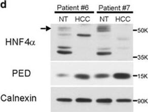 Detection of Human PEA-15 by Western Blot