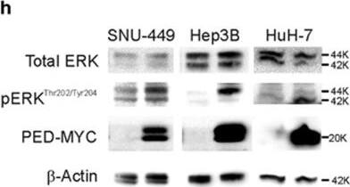 Detection of Human PEA-15 by Western Blot